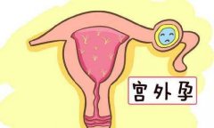 ˮкٴ