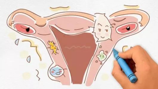 孕妇宫颈炎怎样治疗？