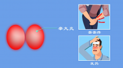 ˯غʹô