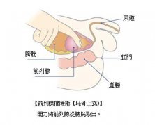 ϸ