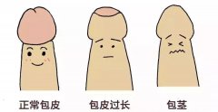 ʲôʱã