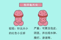 ͷ׵ԭ