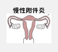 Ըʲô